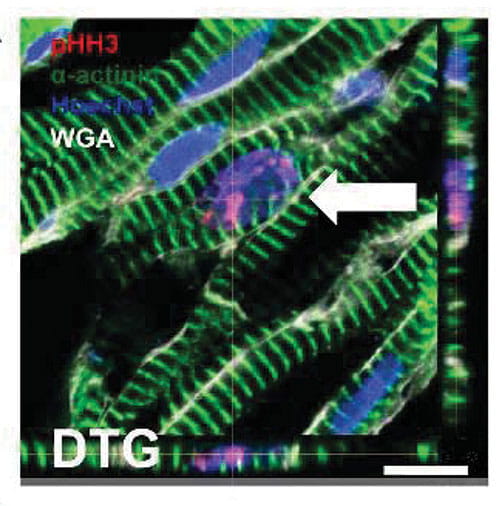 Fig 2A:  The green striations in this confocal microscope image helped confirm that inducing overexpression of the Tbx20 protein in mouse heart tissue can promote heart muscle cell growth.